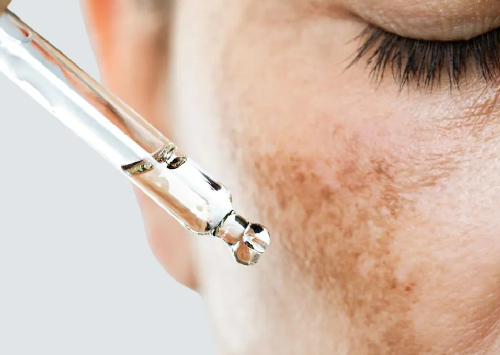 Pigmentation Treatment