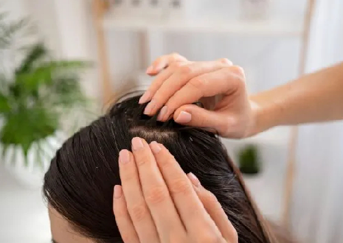 Dandruff Treatment