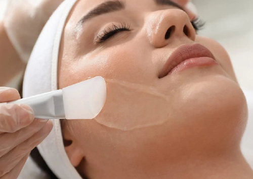 Chemical Peels