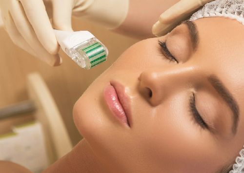 Microneedling